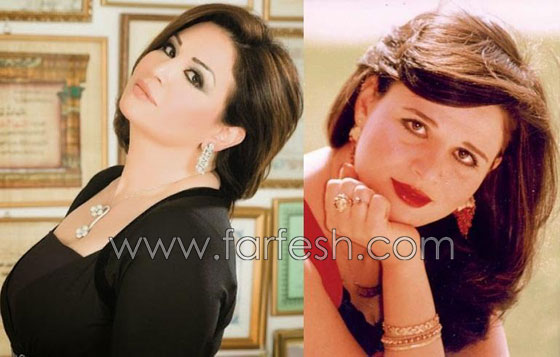 صور 14 فنانة مصرية قبل وبعد عمليات التجميل.. الفرق هائل! صورة رقم 12