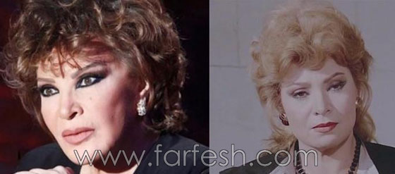 صور 14 فنانة مصرية قبل وبعد عمليات التجميل.. الفرق هائل! صورة رقم 13