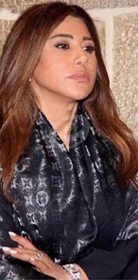 عملية تجميل جديدة تشوه جمال نجوى كرم! شاهد الفيديو والصور صورة رقم 2