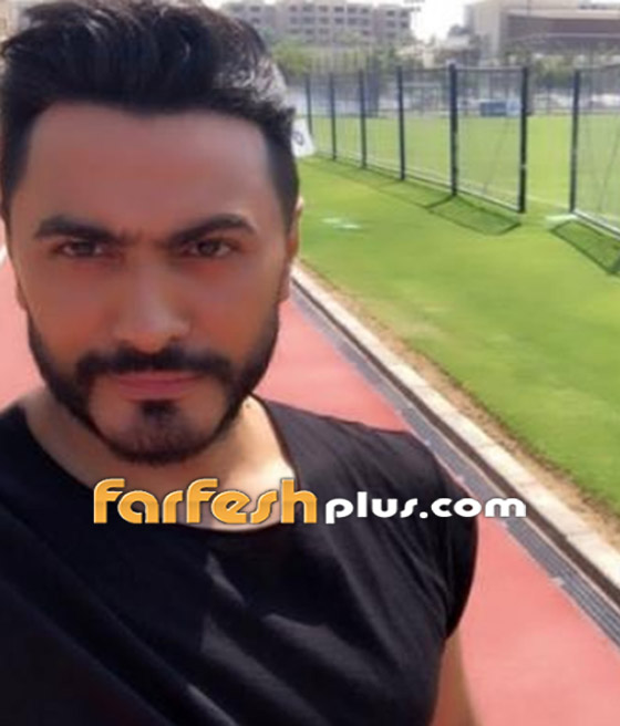 ما سر الجراحة السرية التي يقال أنها أجريت للفنان تامر حسني؟ صورة رقم 11
