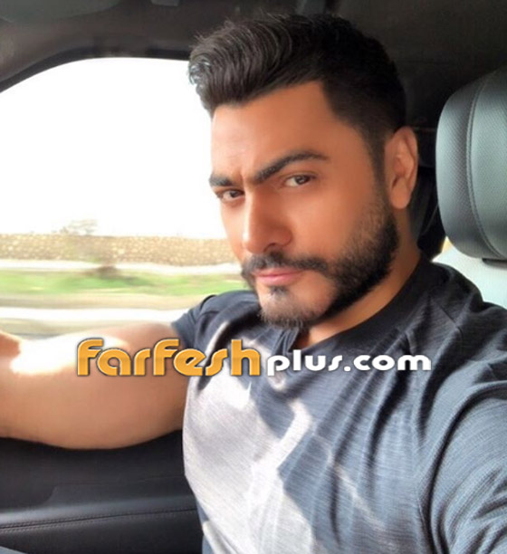 ما سر الجراحة السرية التي يقال أنها أجريت للفنان تامر حسني؟ صورة رقم 12