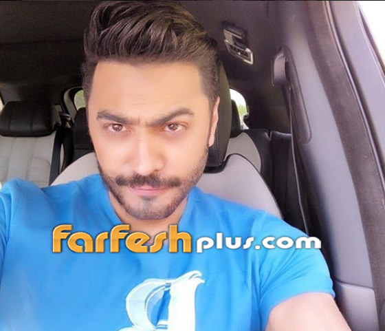 ما سر الجراحة السرية التي يقال أنها أجريت للفنان تامر حسني؟ صورة رقم 15