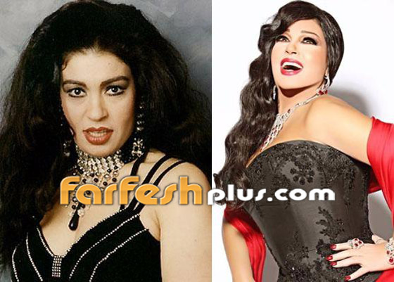 صور نجمات الفن قبل وبعد عمليات التجميل.. البعض تشوه وجههن! صورة رقم 19