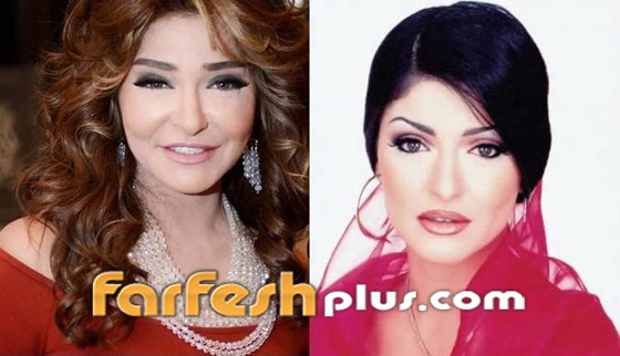 صور نجمات الفن قبل وبعد عمليات التجميل.. البعض تشوه وجههن! صورة رقم 20