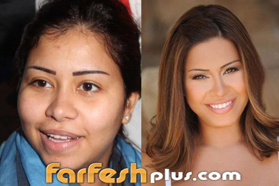 صور نجمات الفن قبل وبعد عمليات التجميل.. البعض تشوه وجههن! صورة رقم 21
