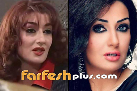 صور نجمات الفن قبل وبعد عمليات التجميل.. البعض تشوه وجههن! صورة رقم 22