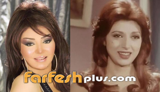 صور نجمات الفن قبل وبعد عمليات التجميل.. البعض تشوه وجههن! صورة رقم 23