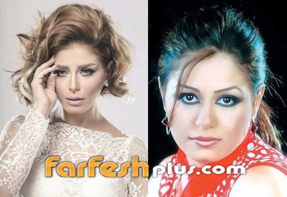 صور نجمات الفن قبل وبعد عمليات التجميل.. البعض تشوه وجههن! صورة رقم 24
