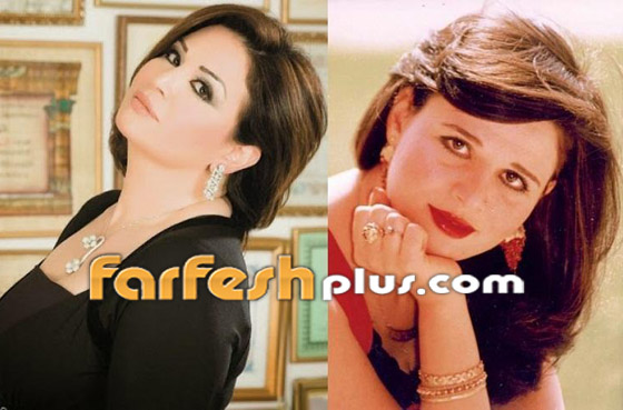صور نجمات الفن قبل وبعد عمليات التجميل.. البعض تشوه وجههن! صورة رقم 25