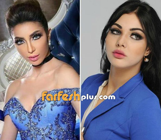 ابتسام تسكت ترد على اتهامات دنيا بطمة: جمالي طبيعي والله يبعدها عني! صورة رقم 2