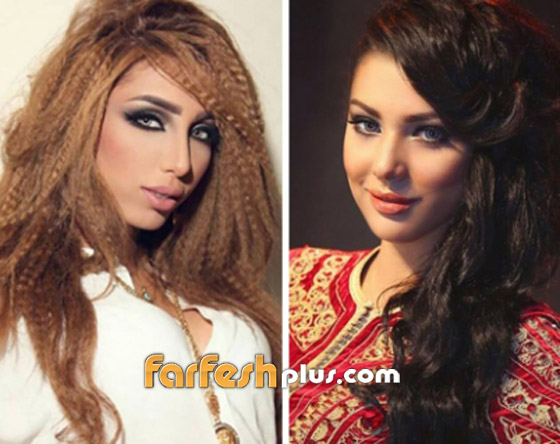 ابتسام تسكت ترد على اتهامات دنيا بطمة: جمالي طبيعي والله يبعدها عني! صورة رقم 3