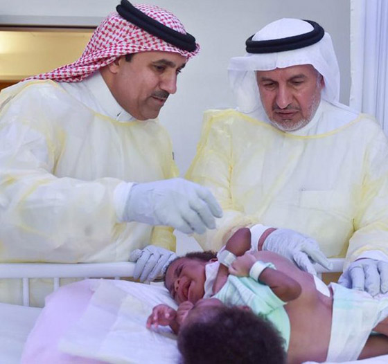 فيديو: والدة توأم سيامي تعلن اسلامها بعد نجاح طبيب سعودي بفصل توأمها صورة رقم 3