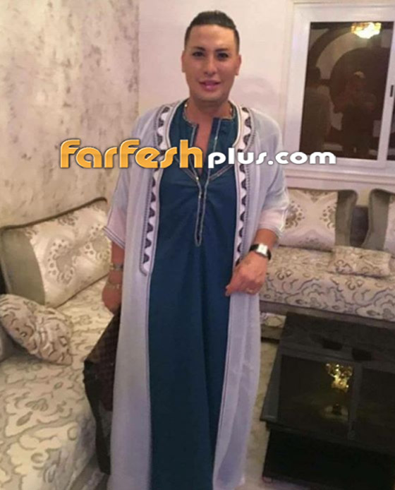 ما سبب وفاة هواري المنار مغني الراي الجزائري أثناء جراحة شفط دهون؟ صورة رقم 11