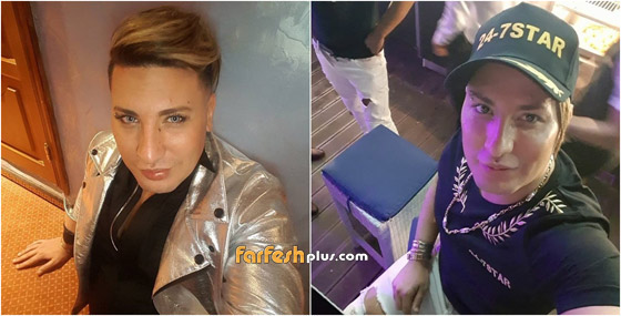 عمليات تجميل سببت للنجوم تشوهات ومعاناة وصلت لحد الوفاة! صورة رقم 1