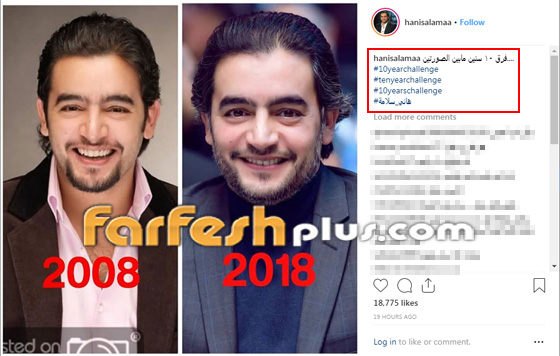 صور 17 نجما ونجمة شاركوا في تحدي الـ 10 سنوات، هل تغيروا كثيرا؟ صورة رقم 7