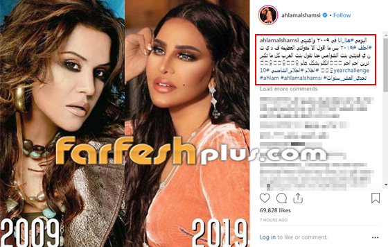صور 17 نجما ونجمة شاركوا في تحدي الـ 10 سنوات، هل تغيروا كثيرا؟ صورة رقم 13