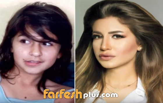 كيف تغير شكل نجوم الطفولة بعد 10 سنين؟ منهم أحمد مالك ومنه عرفة  صورة رقم 9