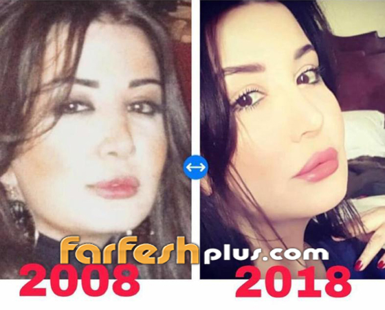النجوم السوريون ينضمون للتحدي وينشرون صورهم قبل 10 سنوات فهل تغيرت أشكالهم؟ صورة رقم 2