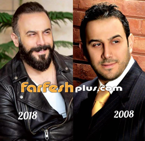 النجوم السوريون ينضمون للتحدي وينشرون صورهم قبل 10 سنوات فهل تغيرت أشكالهم؟ صورة رقم 5