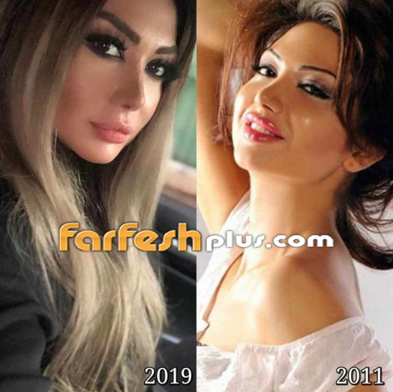 النجوم السوريون ينضمون للتحدي وينشرون صورهم قبل 10 سنوات فهل تغيرت أشكالهم؟ صورة رقم 6