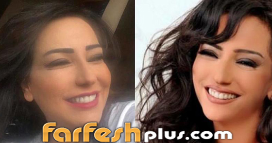 النجوم السوريون ينضمون للتحدي وينشرون صورهم قبل 10 سنوات فهل تغيرت أشكالهم؟ صورة رقم 8