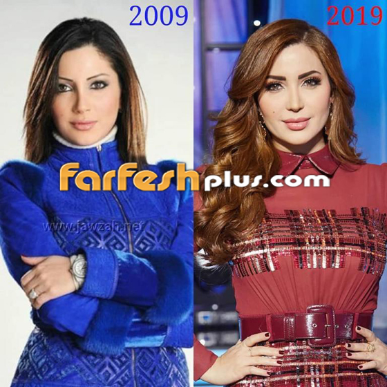 النجوم السوريون ينضمون للتحدي وينشرون صورهم قبل 10 سنوات فهل تغيرت أشكالهم؟ صورة رقم 9