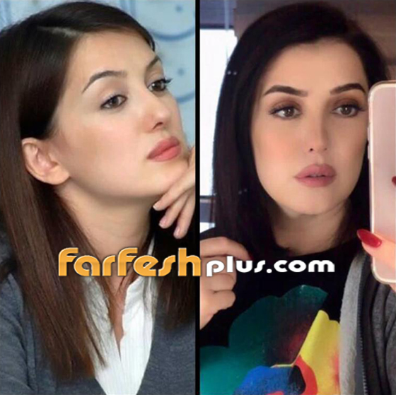 النجوم السوريون ينضمون للتحدي وينشرون صورهم قبل 10 سنوات فهل تغيرت أشكالهم؟ صورة رقم 10