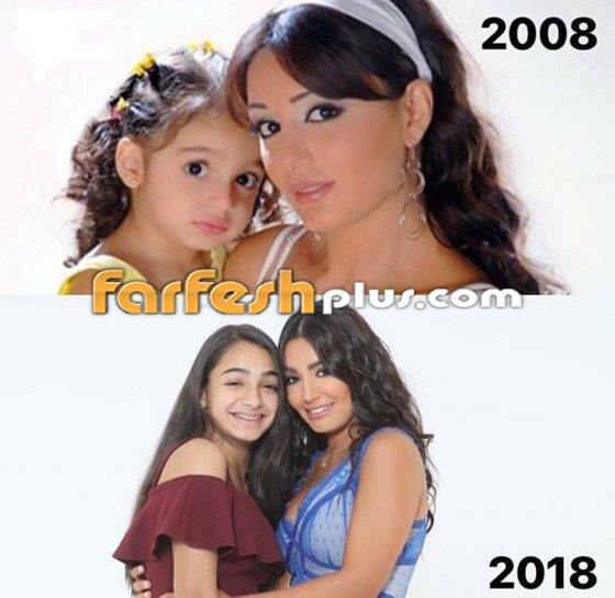 النجوم السوريون ينضمون للتحدي وينشرون صورهم قبل 10 سنوات فهل تغيرت أشكالهم؟ صورة رقم 11