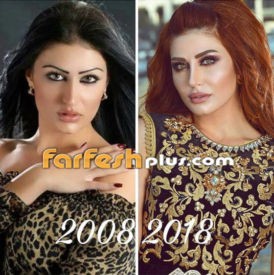 النجوم السوريون ينضمون للتحدي وينشرون صورهم قبل 10 سنوات فهل تغيرت أشكالهم؟ صورة رقم 17