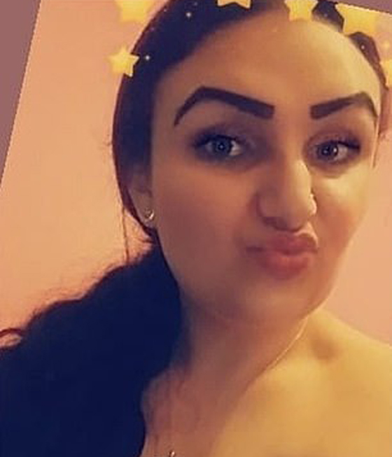 صبغة شعر تتسبب بتضخم وجه مراهقة وتصيبها بالعمى لمدة يومين! صور صورة رقم 7