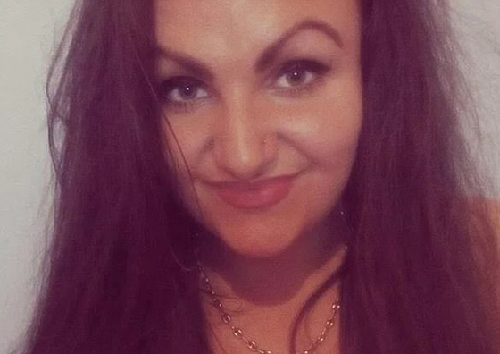 صبغة شعر تتسبب بتضخم وجه مراهقة وتصيبها بالعمى لمدة يومين! صور صورة رقم 8