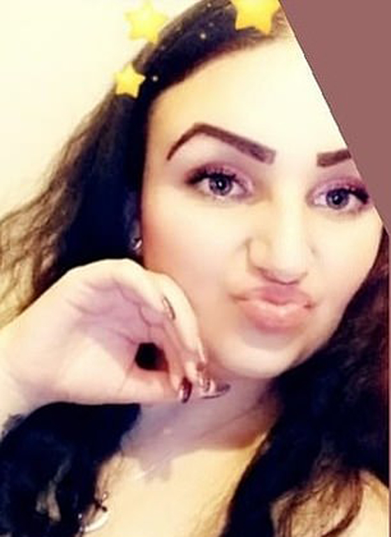 صبغة شعر تتسبب بتضخم وجه مراهقة وتصيبها بالعمى لمدة يومين! صور صورة رقم 9