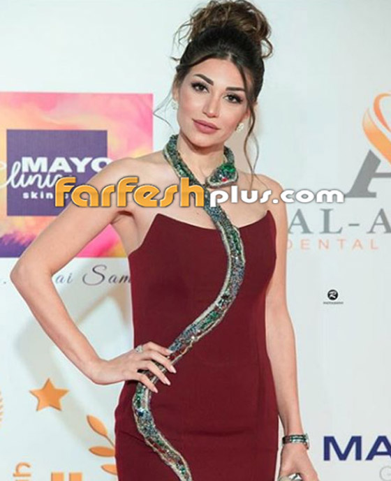 نجمات ضربهن أزواجهن: سارة نخلة، ريم البارودي ورانيا يوسف! صورة رقم 1