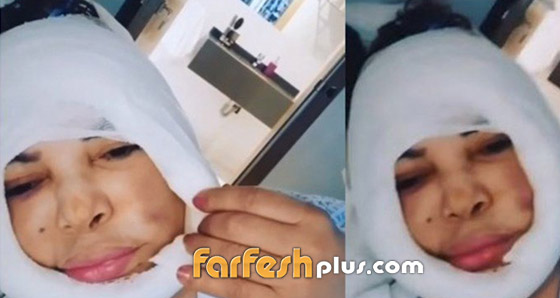  فيديو صادم: ما الذي حدث لوجه فلة الجزائرية وكيف تشوه وانتفخ بهذا الشكل؟؟ صورة رقم 1