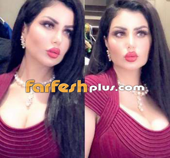 صور حليمة بولند بشفاه منتفخة تثير الجدل! الجمهور بين منتقد ومتغزل بجمالها صورة رقم 1