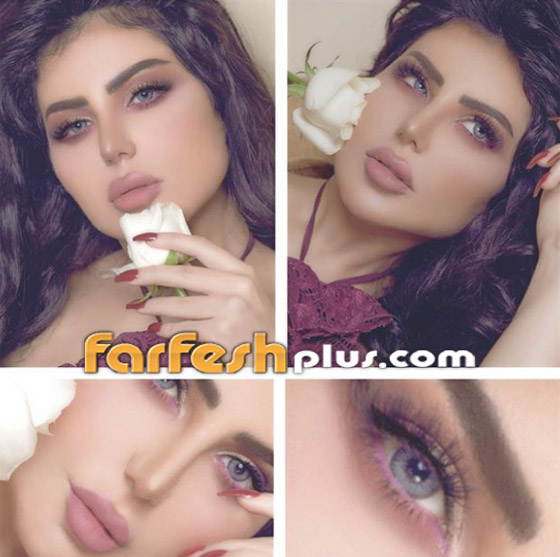 صور حليمة بولند بشفاه منتفخة تثير الجدل! الجمهور بين منتقد ومتغزل بجمالها صورة رقم 3