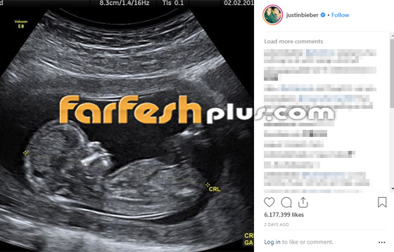 فيديو: جاستن بيبر يعلن حمل زوجته ثم يصفعها في الشارع! ما الحكاية؟ صورة رقم 1