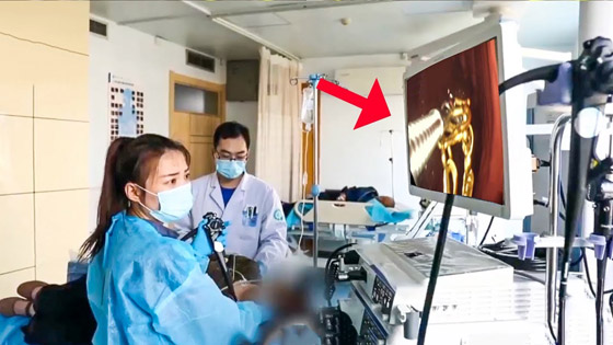 بالفيديو: سيدة تبتلع سلسلتها الذهبية بسبب شجار عائلي صورة رقم 2