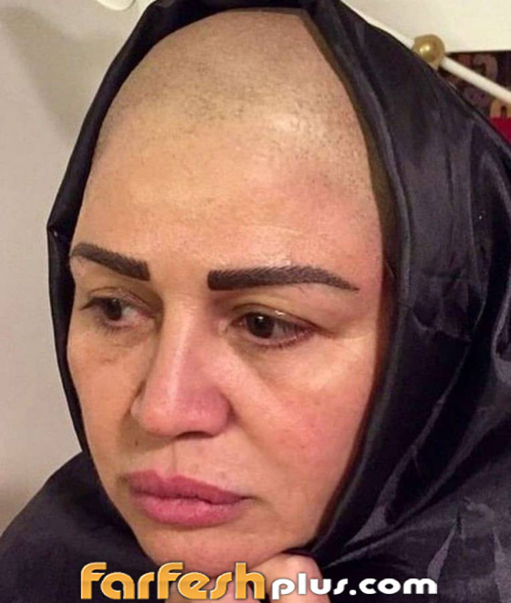 نجمات عربيات وعالميات ظهرن بشعر محلوق (عالزيرو) دعما لمريضات السرطان صورة رقم 3