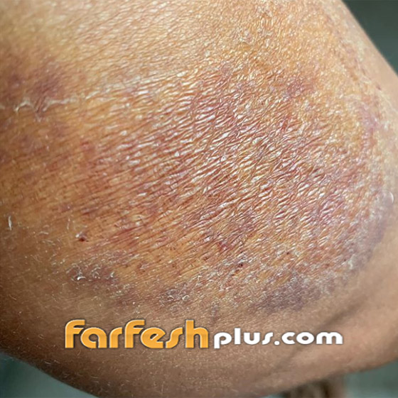 اعتداء مقصود على مذيعة عربية: إصابات خطيرة وفقدت القدرة على المشي! صورة رقم 5