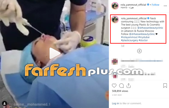 رولا يموت أخت هيفاء وهبي تخضع لعملية، شاهد صورها بدون مكياج صورة رقم 1
