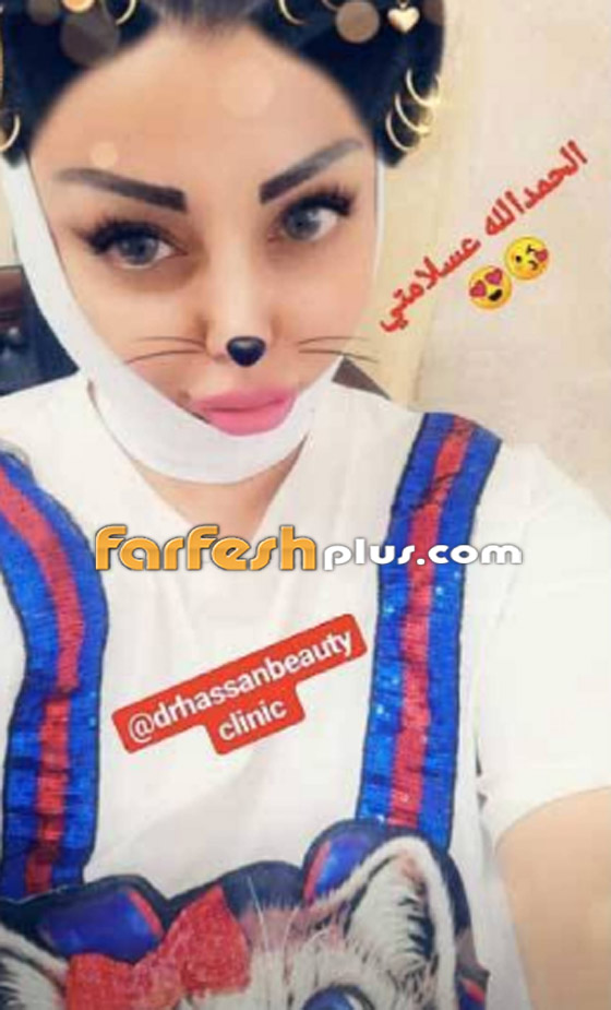 رولا يموت أخت هيفاء وهبي تخضع لعملية، شاهد صورها بدون مكياج صورة رقم 2