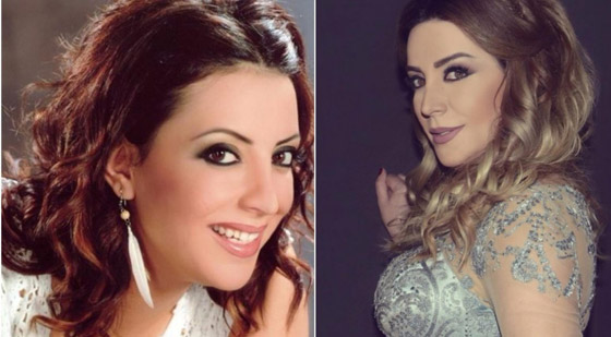 نجمات هن الأكثر توفيقاً في العمليات التجميلية عبر التاريخ!  صورة رقم 1
