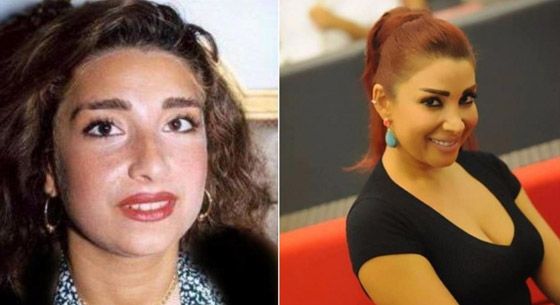 نجمات هن الأكثر توفيقاً في العمليات التجميلية عبر التاريخ!  صورة رقم 4