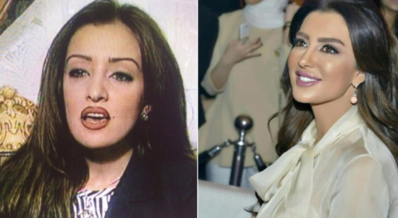 نجمات هن الأكثر توفيقاً في العمليات التجميلية عبر التاريخ!  صورة رقم 5