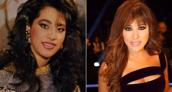 نجمات هن الأكثر توفيقاً في العمليات التجميلية عبر التاريخ!  صورة رقم 6