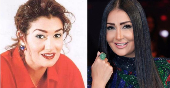 نجمات هن الأكثر توفيقاً في العمليات التجميلية عبر التاريخ!  صورة رقم 7