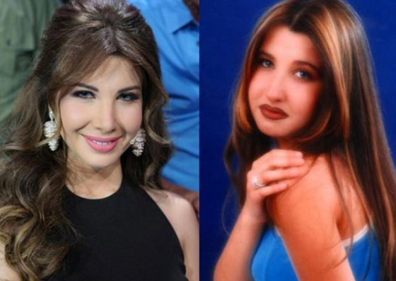 نجمات هن الأكثر توفيقاً في العمليات التجميلية عبر التاريخ!  صورة رقم 9