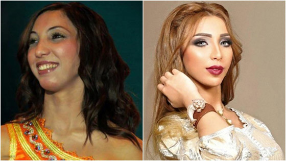 نجمات هن الأكثر توفيقاً في العمليات التجميلية عبر التاريخ!  صورة رقم 10