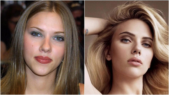نجمات هن الأكثر توفيقاً في العمليات التجميلية عبر التاريخ!  صورة رقم 11